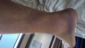 20251001_170150 20251001_170150