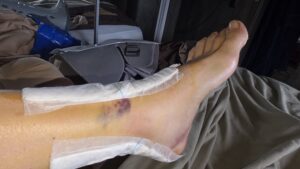 20251010_095446 20251010_095446