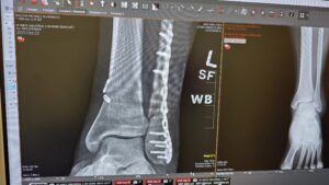 20251023_110332 20251023_110332